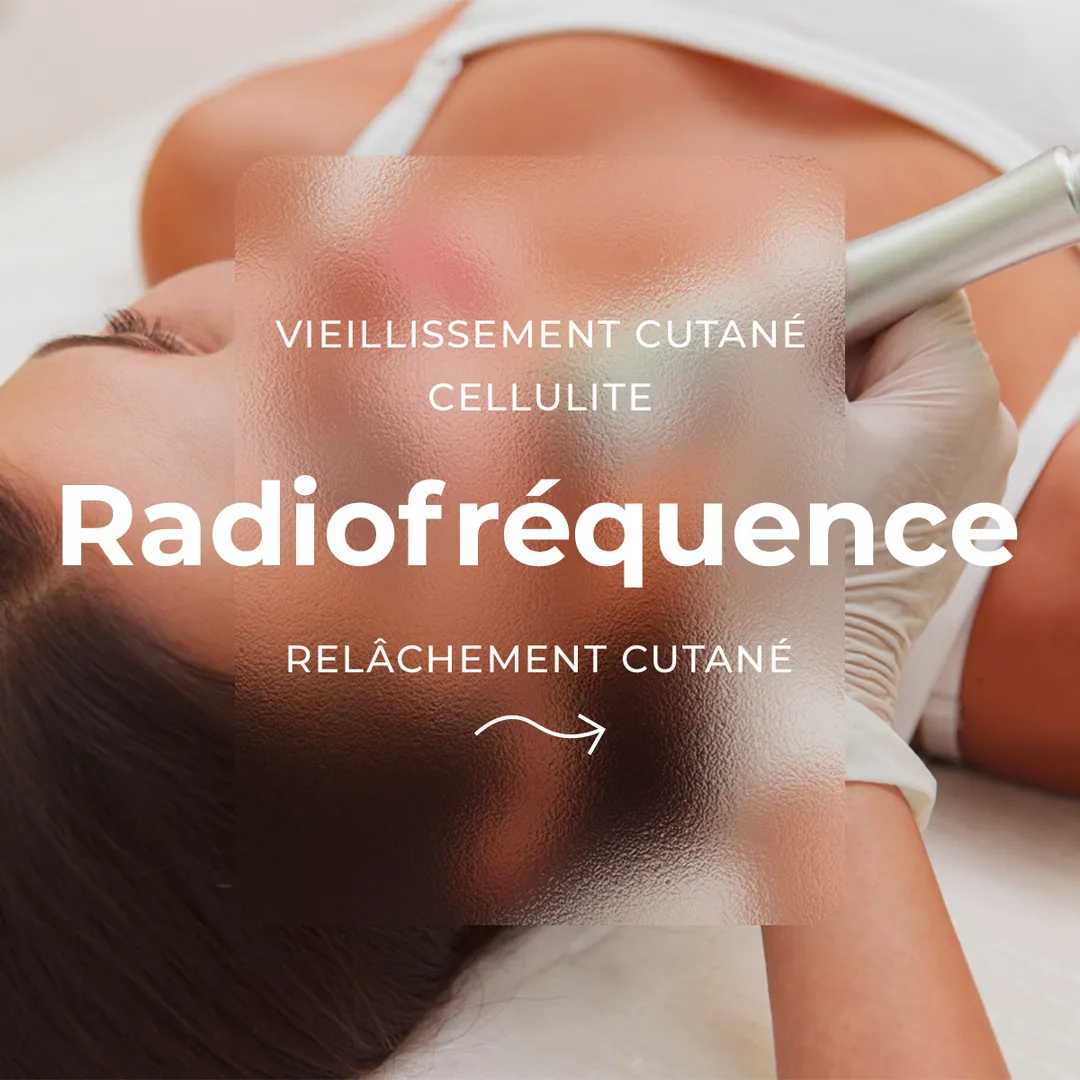 Radiofréquence